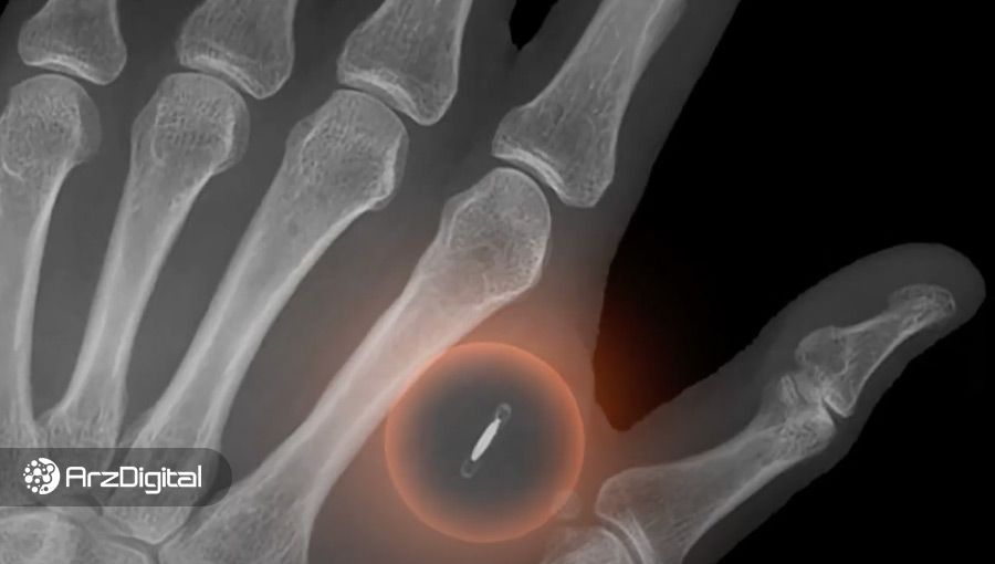 لایتنینگ بیت کوین